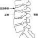 圧迫骨折は整体の適応外