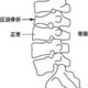 圧迫骨折は整体の適応外